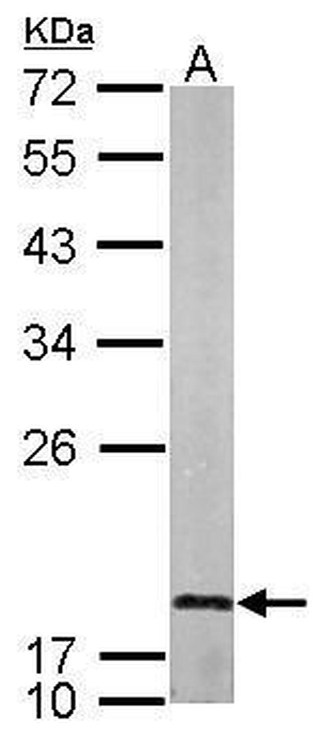 LMO1 Antibody in Western Blot (WB)