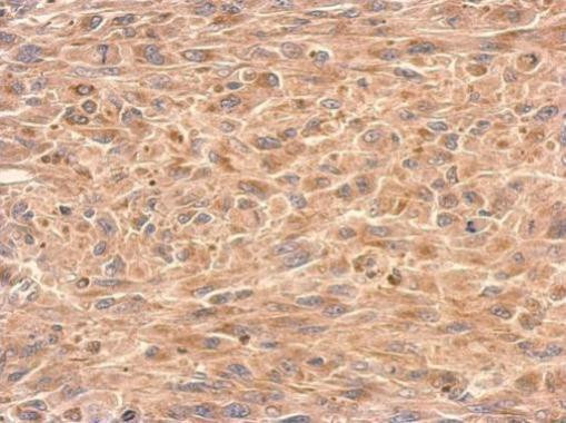 GDI1 Antibody in Immunohistochemistry (Paraffin) (IHC (P))