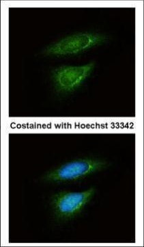 LDHB Antibody in Immunocytochemistry (ICC/IF)