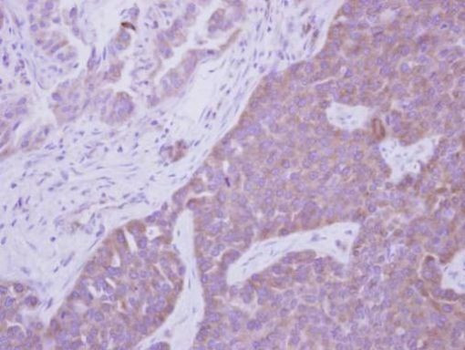 ARHGEF7 Antibody in Immunohistochemistry (Paraffin) (IHC (P))
