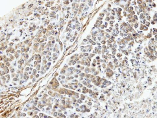 TUFM Antibody in Immunohistochemistry (Paraffin) (IHC (P))