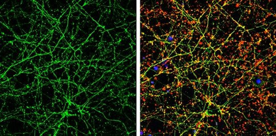 Calmodulin 2 Antibody in Immunocytochemistry (ICC/IF)
