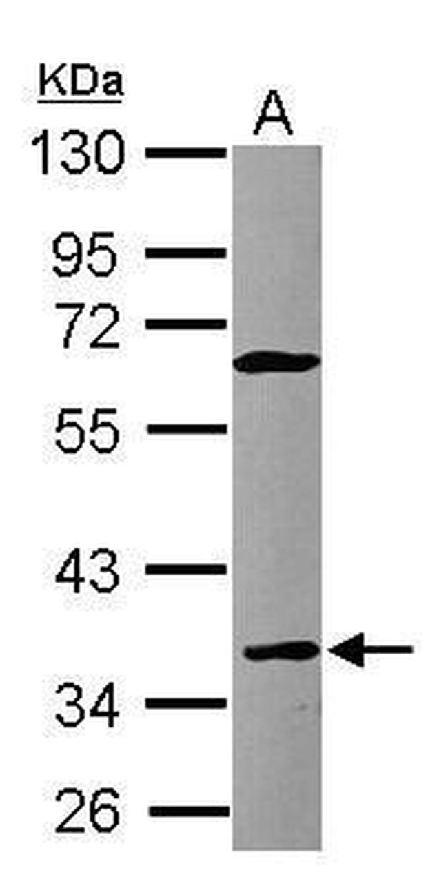CD23 Antibody in Western Blot (WB)