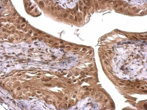 FUS Antibody in Immunohistochemistry (Paraffin) (IHC (P))