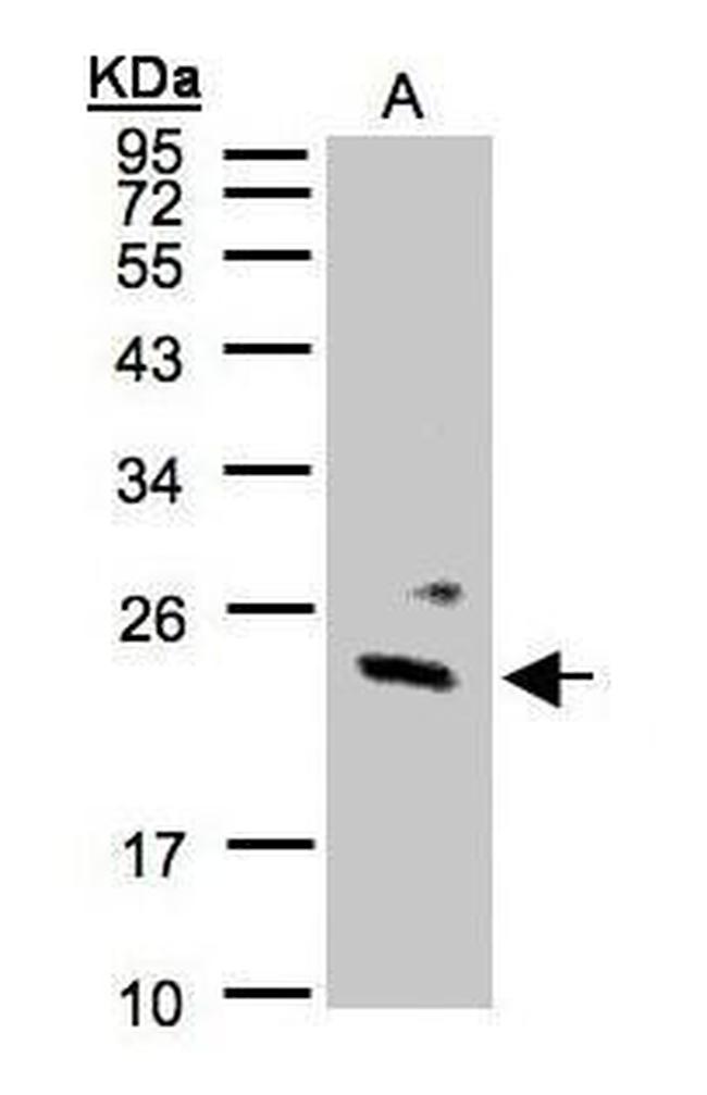 GUK1 Antibody in Western Blot (WB)
