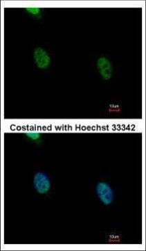hnRNP K Antibody in Immunocytochemistry (ICC/IF)