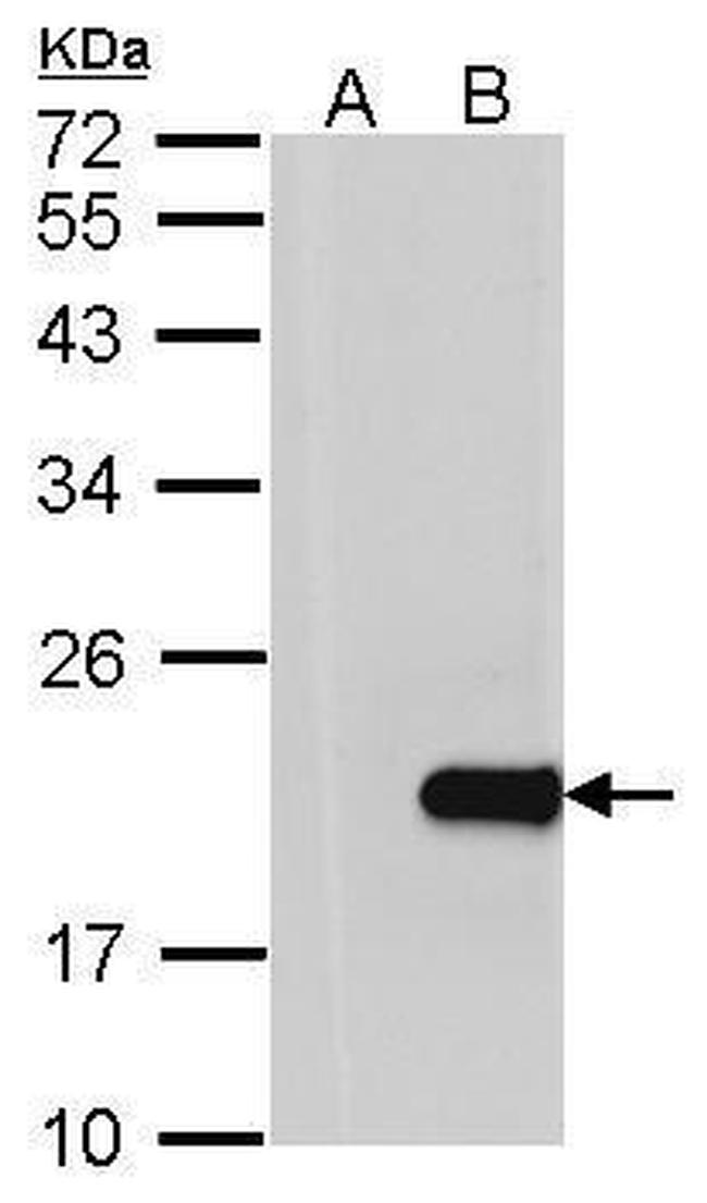 HPCAL1 Antibody in Western Blot (WB)