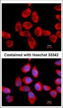 RPLP2 Antibody in Immunocytochemistry (ICC/IF)
