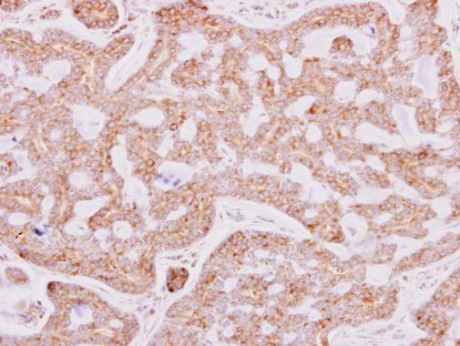 RPL15 Antibody in Immunohistochemistry (Paraffin) (IHC (P))