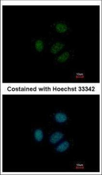RPS15 Antibody in Immunocytochemistry (ICC/IF)