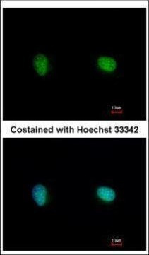 Ku70 Antibody in Immunocytochemistry (ICC/IF)