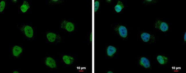 hnRNP AB Antibody in Immunocytochemistry (ICC/IF)