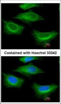 beta Tubulin 2 Antibody in Immunocytochemistry (ICC/IF)