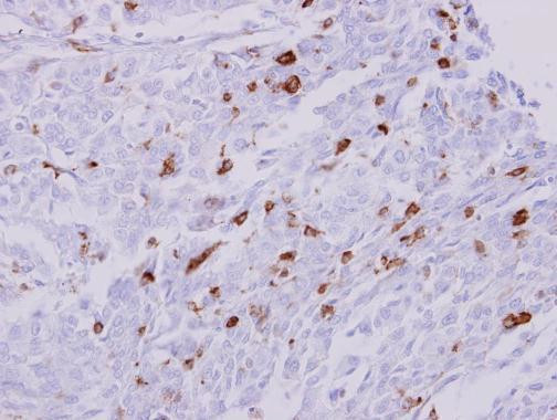 HLA-DRA Antibody in Immunohistochemistry (Paraffin) (IHC (P))