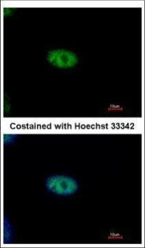 NYREN18 Antibody in Immunocytochemistry (ICC/IF)