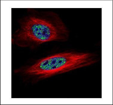 SNRPB Antibody in Immunocytochemistry (ICC/IF)