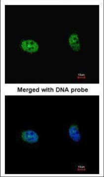 RPS6KB2 Antibody in Immunocytochemistry (ICC/IF)