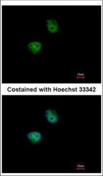 RPS6KB2 Antibody in Immunocytochemistry (ICC/IF)