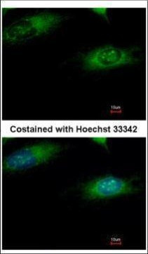 Ribophorin I Antibody in Immunocytochemistry (ICC/IF)