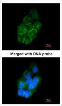 Annexin A2 Antibody in Immunocytochemistry (ICC/IF)
