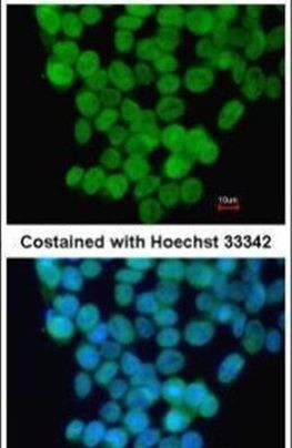 Rex1 Antibody in Immunocytochemistry (ICC/IF)