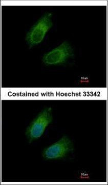 GOT2 Antibody in Immunocytochemistry (ICC/IF)