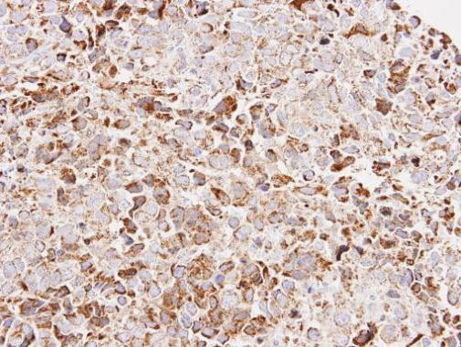 ATP Synthase O Antibody in Immunohistochemistry (Paraffin) (IHC (P))