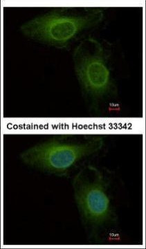 PHGDH Antibody in Immunocytochemistry (ICC/IF)