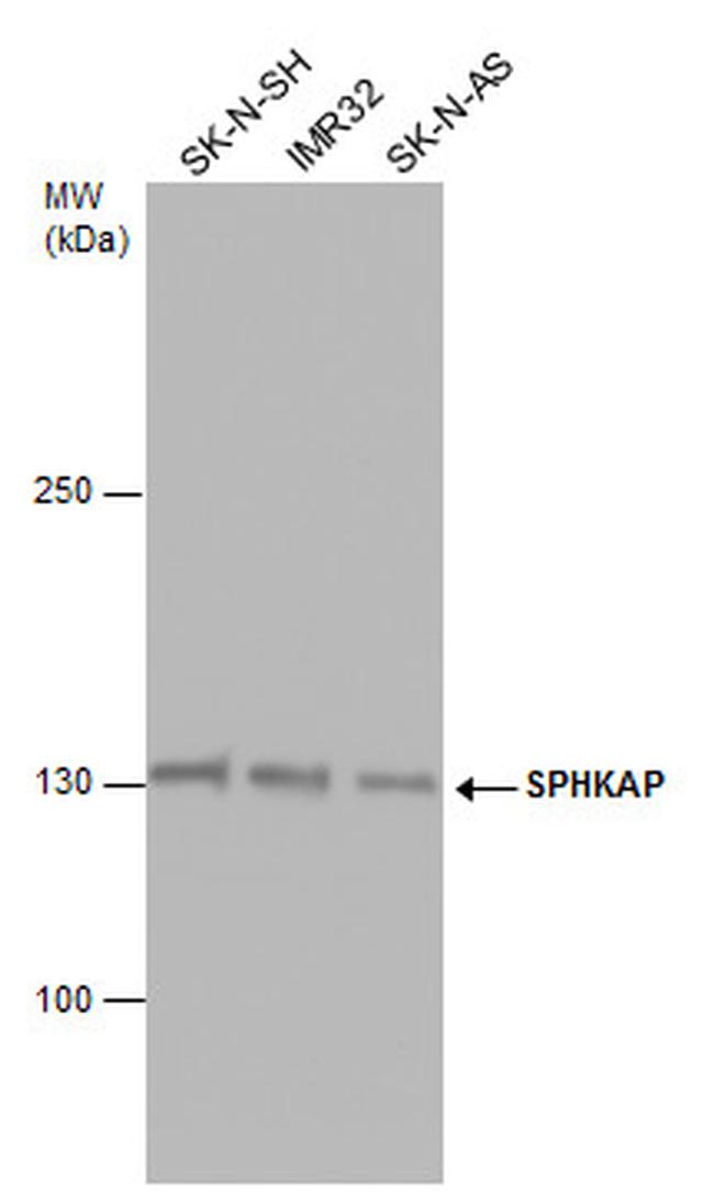 SPHKAP Antibody in Western Blot (WB)
