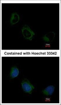 eIF3f Antibody in Immunocytochemistry (ICC/IF)