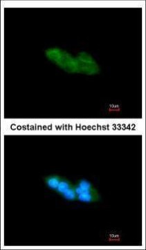 ARMET Antibody in Immunocytochemistry (ICC/IF)