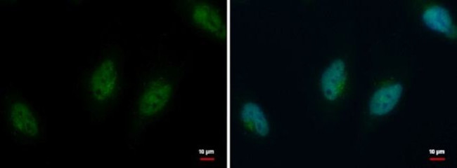 Histone H2A.Z Antibody in Immunocytochemistry (ICC/IF)