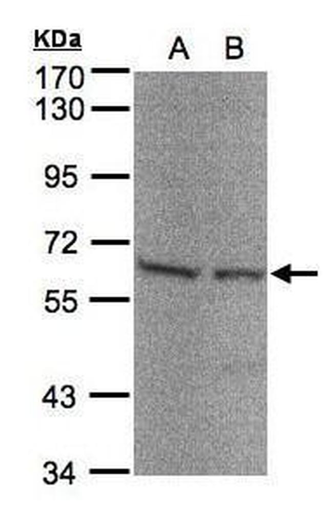 Seryl-tRNA synthetase Antibody in Western Blot (WB)