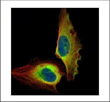 NFkB p65 Antibody in Immunocytochemistry (ICC/IF)