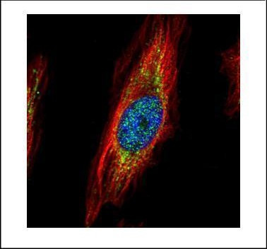 TRIM27 Antibody in Immunocytochemistry (ICC/IF)