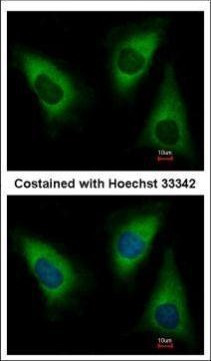 KARS Antibody in Immunocytochemistry (ICC/IF)