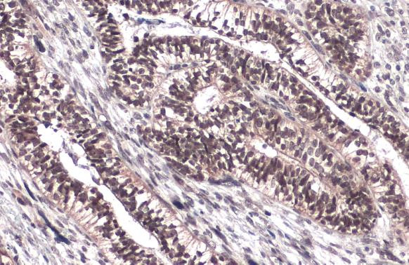 FOXM1 Antibody in Immunohistochemistry (Paraffin) (IHC (P))