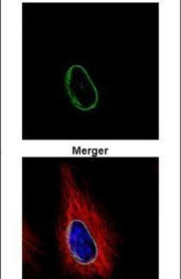 POM121 Antibody in Immunocytochemistry (ICC/IF)