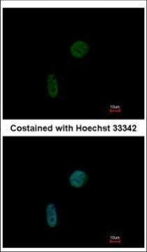 CIZ1 Antibody in Immunocytochemistry (ICC/IF)