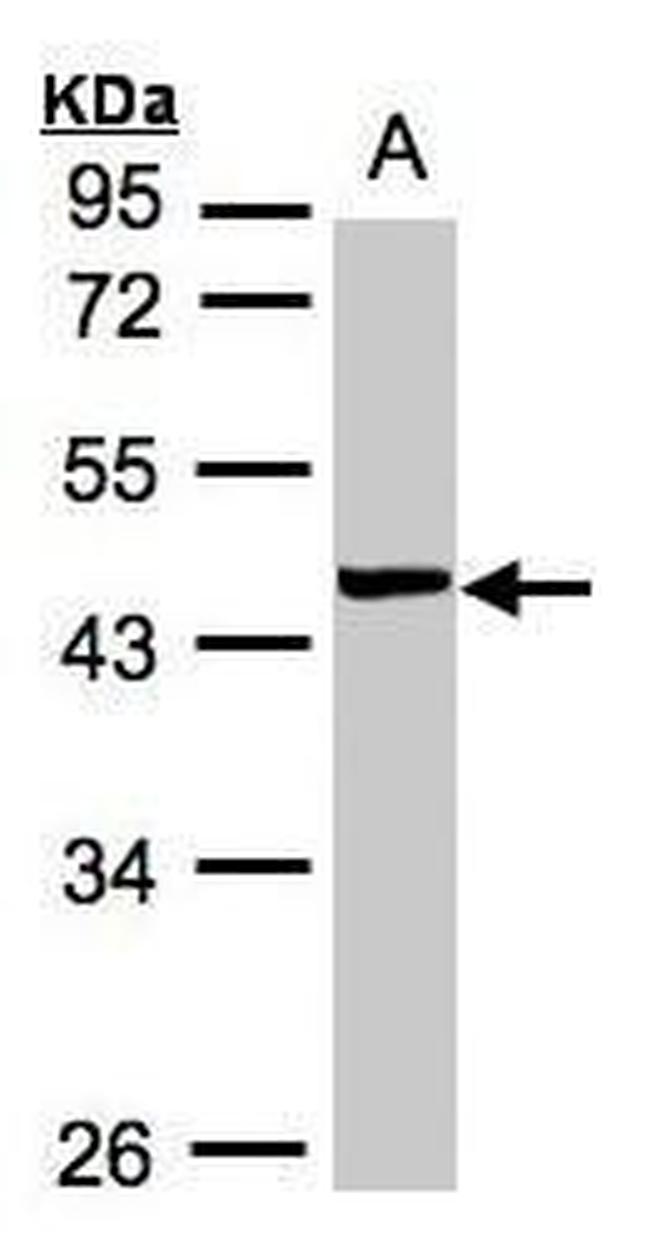 VPS72 Antibody in Western Blot (WB)