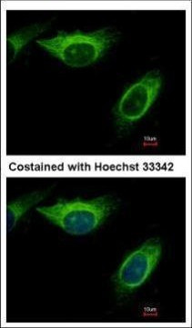 MEK2 Antibody in Immunocytochemistry (ICC/IF)