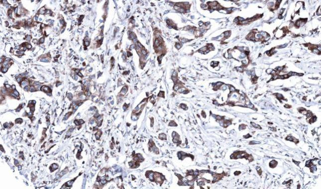 MEK2 Antibody in Immunohistochemistry (Paraffin) (IHC (P))