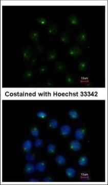 SAR1A Antibody in Immunocytochemistry (ICC/IF)