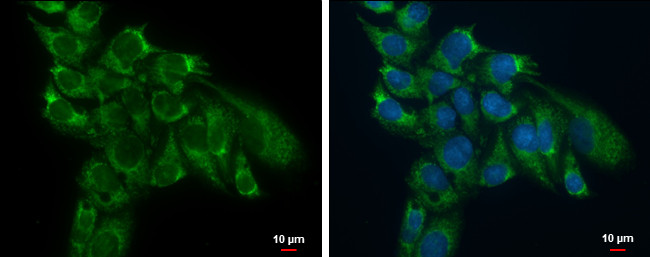 TSFM Antibody in Immunocytochemistry (ICC/IF)