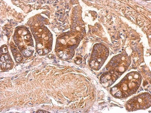 EEF2 Antibody in Immunohistochemistry (Paraffin) (IHC (P))