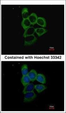 PSMD2 Antibody in Immunocytochemistry (ICC/IF)