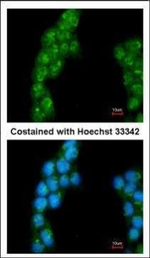 PSMD3 Antibody in Immunocytochemistry (ICC/IF)
