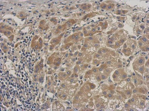 ALS Antibody in Immunohistochemistry (Paraffin) (IHC (P))