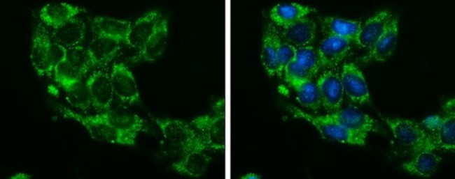 Glycerol kinase Antibody in Immunocytochemistry (ICC/IF)
