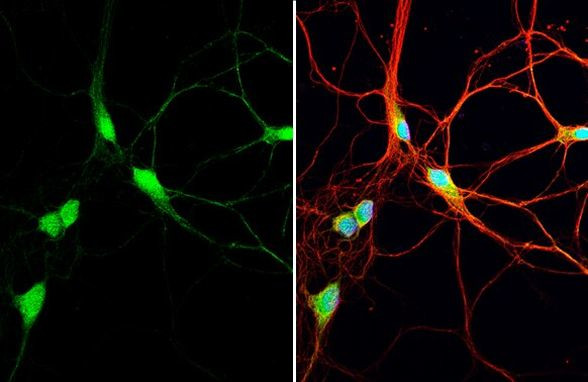 AHA1 Antibody in Immunocytochemistry (ICC/IF)
